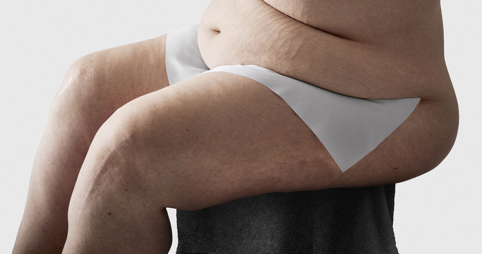 Hautfalten gezielt und effektiv versorgen