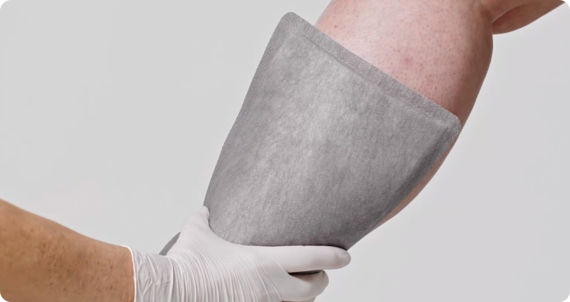 Applikation des Biatain® Superabsorbers - Größe: 20 cm x 25 cm